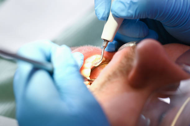 Best Emergency Care for Gum Disease in Milam, TX